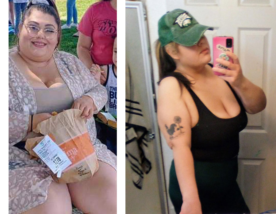 Elite Bariatric testimonial