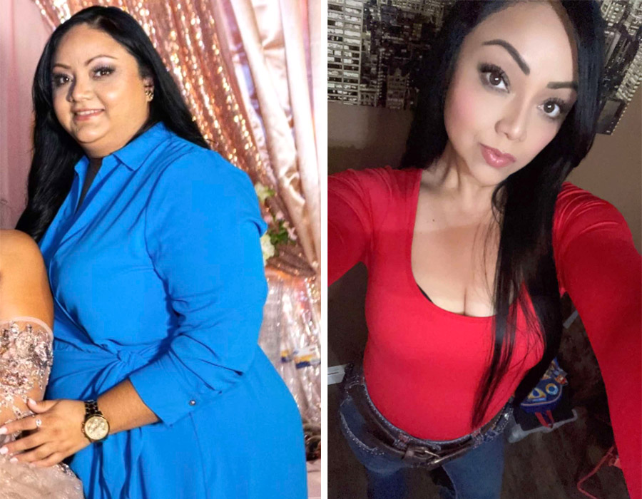 Elite Bariatric testimonial