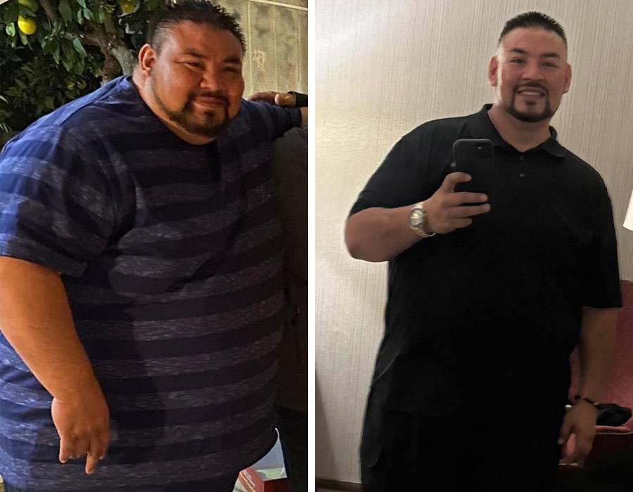 Elite Bariatric testimonial