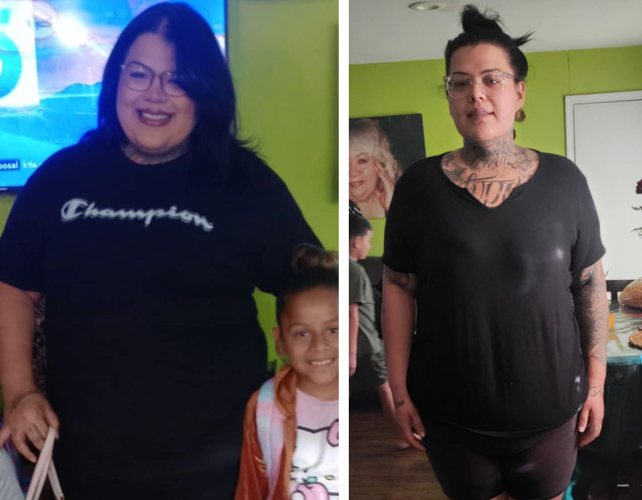 Elite Bariatric testimonial