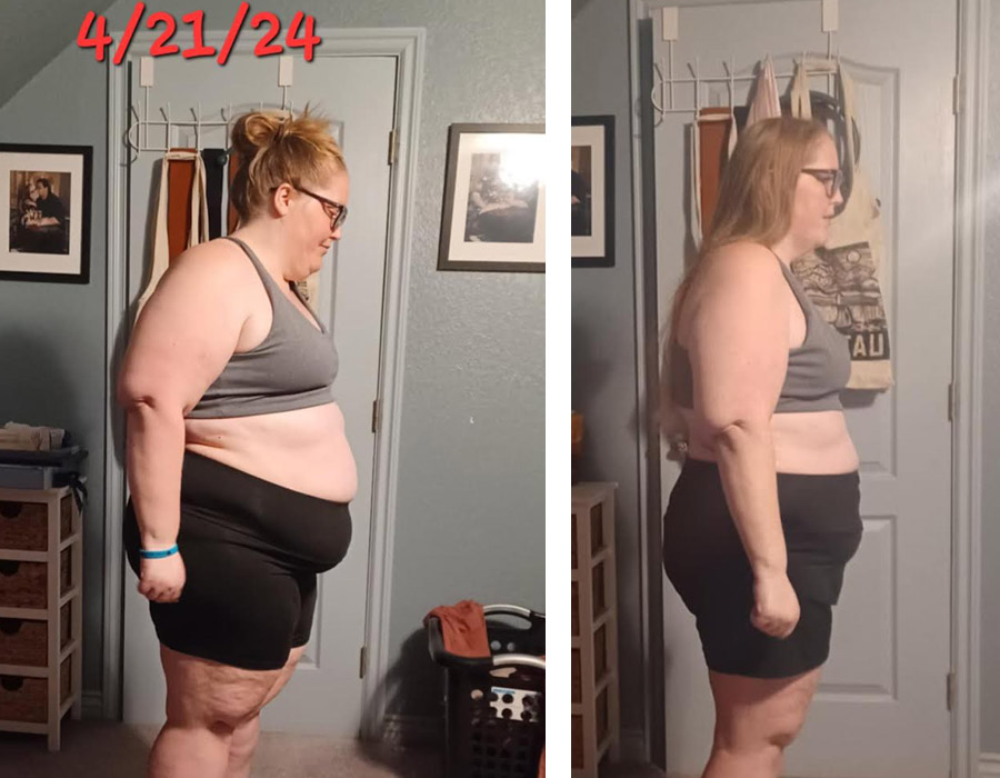 Elite Bariatric testimonial